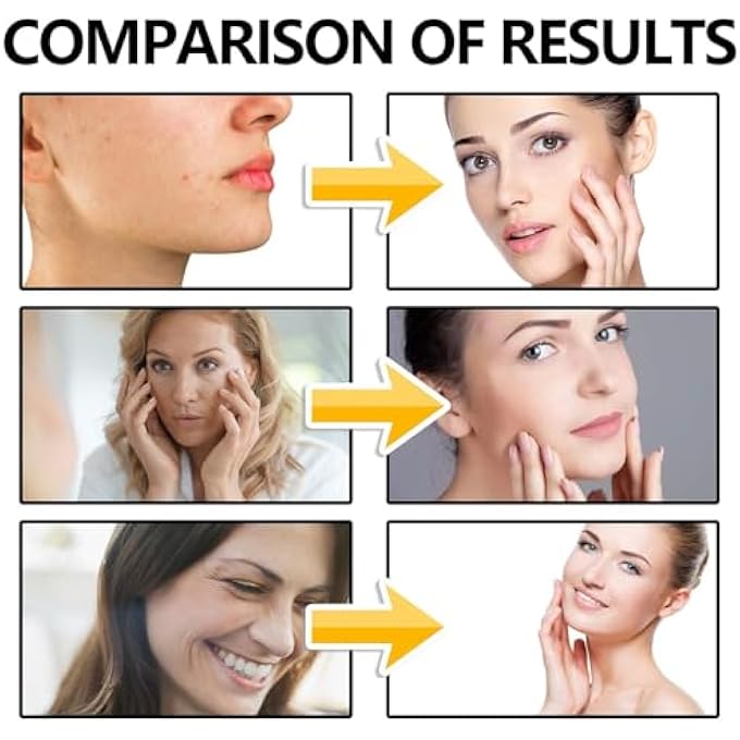 STRBOXONG KIT DE INFUSIN DE BELLEZA, KIT DE SISTEMA DE MICROINFUSIN PARA ROSTRO, SISTEMA DE MICROINFUSIN PARA LABIOS, KIT DE MICROINFUSIN, SUERO FACIAL DE PIEL SUAVE PARA TODO TIPO DE PIEL (2SET) - Image 4